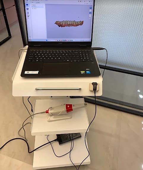 Intraoral scanner at V-Dent Dental Care, with a digital scan of a dental arch shown on screen